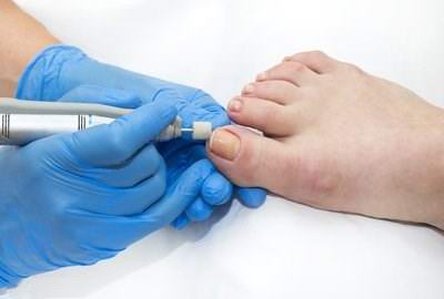 修腳加盟店教大家如何對足部養(yǎng)護(hù)