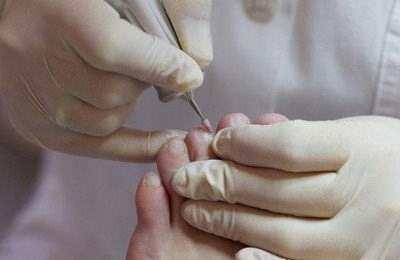 洛陽(yáng)愛足康修腳堂|如何治療甲溝炎